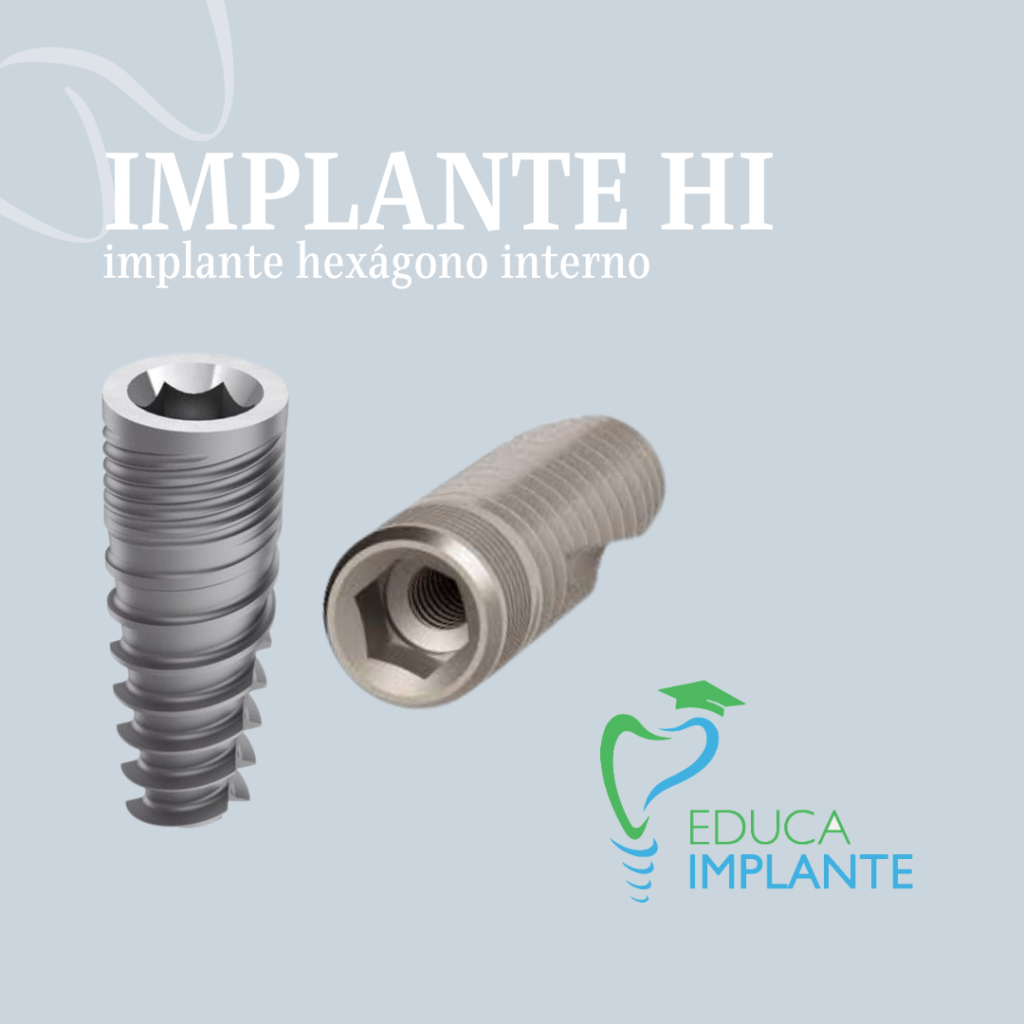 Conhecendo a conexão hexágono interna – HI